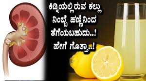 Easy Way To Remove Kidney Stone Using Lemon Kannada Health Tips Top Kannada Tv Youtube