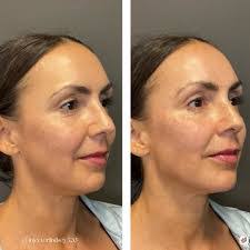 Lindsey Kincaid's Instagram, Twitter & Facebook