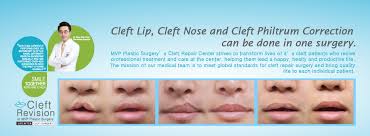 How long will it take to recover? Cleft Surgery Korea Home Facebook