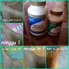 3 jenis obat gatal kulit yang ada di apotek 1. Atasi Penyakit Gatal Kulit Kurap Dan Eczema Dengan Produk Shaklee Vitamin Wawa Pengedar Shaklee Aktif
