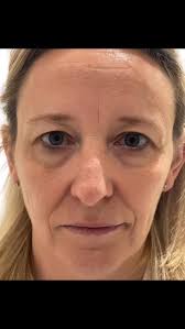 ✨ Restoring Natural Balance and Freshness ✨, (Long post alert