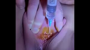 Urethral injection - XVIDEOS.COM