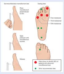 Search for eschar wound definition. Identifying And Treating Foot Ulcers In Patients With Diabetes Saving Feet Legs And Lives Journal Of Wound Care