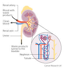 Types And Grades Kidney Cancer Cancer Research Uk