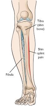 The calf is made up of the large gastrocnemius muscle the gastrocnemius muscle, also known as the gastroc, is the portion of the lower leg that generates most of the force when you contract the muscle. Shin Splints Orthoinfo Aaos