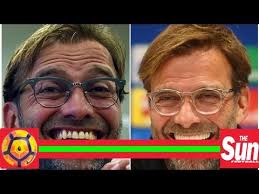 Jurgen klopp is an exceptional coach but i think liverpool and jurgen klopp are content with if klopp were to leave this summer or something i wouldn't want gerrard anywhere near the job. Has Jurgen Klopp Had His Teeth Done Liverpool Manager Shows Pearly Whites In Press Conference Youtube