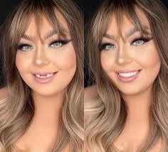 Love your Smile Logan Nova great photo