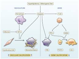 Chemal & gegg linda model.rar: The Roles Of Lipid Oxidation Products And Receptor Activator Of Nuclear Factor Kb Signaling In Atherosclerotic Calcification Abstract Europe Pmc