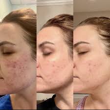 TOP 10 BEST Microblading Eyebrows near Pineville, NC