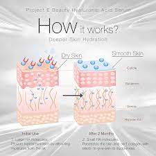 Enjoy free shipping, returns & complimentary gift wrapping. Buy Project E Beauty Hyaluronic Acid Serum With Vitamin C Vitamin E Plumping Anti Aging Hydrating Moisturizing Dark Spot Remover For Skin Facial Eyes Treatment 1oz Online In Tunisia B07gl2tsgb