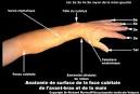 Fracture de laposavant-bras - Tout savoir - m