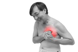Ischemic Heart Disease Social Security Disability Benefits Attorney In New Jersey