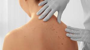 Cilt Hastaliklari Nelerdir Cilt Hastaliklarinin Nedenleri Ve Belirtileri Saglik Son Dakika Haberler