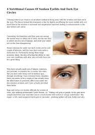 Here in market alot of cosmetic products and creams are available to treat dark eyelids, but all such products are expensive, unnatural and also has chemicals that later may have many other side effects on your skin too. 4 Nutritional Causes Of Sunken Eyelids And Dark Eye Circles