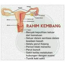 Pada awal penggambaran, saya okey saja dan tak penat. Rahim Jatuh Tombong Peranakkan Jatuh Rahim Kembang Sakit Ari Ari Shopee Malaysia