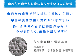 Q＆A集 子の歯イロハ｜保護者のみなさんへ｜小学生歯みがき研究サイト 歯みがKids