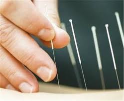 Ihre eingaben sind völlig anonym. Akupunktur Hilft Egal Wo Die Nadeln Sitzen