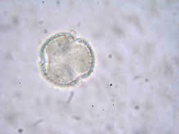 Image result for Colletoecema