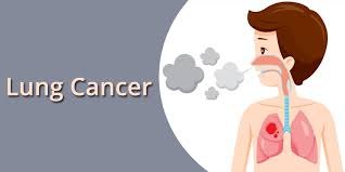 Auscultation of the lungs adventitious (added) sounds three types of adventitious sounds can be heard in pulmonary pathology: Lung Cancer Treatment In Jaipur By Dr Tarachand Medical Oncologist