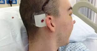 How crash victim who wasn't meant to survive is now helping other brain  injury sufferers