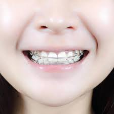 Retainer For Teeth Beautiful Smiling Girl With Retainer For Teeth Dental Retainer Braces Retainer Retainer Teeth