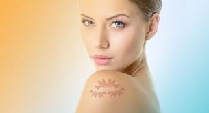Q Switch Lazer Ile Dovme Silme Lotus Dermatoloji