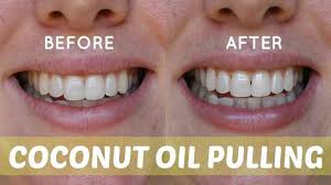 Oil Pulling Has Been Around For Years And Has Already Gained A Lot Of Followers This Procedure Is A Popul Oil Pulling Coconut Oil Pulling Oil Pulling Benefits