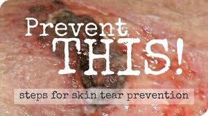 Image result for Skin Tear