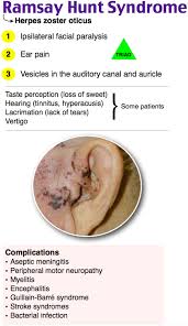 Rosh Review Pediatric Nurse Practitioner Nursing Tips Oral Pathology