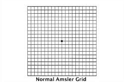 Download Your Free Amsler Grid Specialty Eye Institute