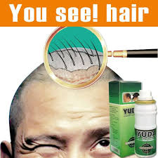 A clinically proven hair regrowth treatment for both men and women. 60ml Powerful Pilatory Hair Growth Treatment Original Regain Hair Loss Treatment Fast Hair Growth Liquid New Hair Loss Products Aliexpress