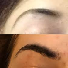 Use the report button on all comments and posts that violate the rules in the sidebar. B A Not Sure It This Is The Right Place For This But Eyebrow Transformation I Started Applying Rogaine Nightly With A Brush Around 5 Months Ago Skincareaddiction