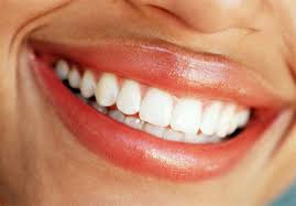 With reasonable precautions, dental veneers can last anywhere from 10 to 30 years. What Are Clip On Veneers How Long Do They Last How Much Do They Cost And Can You Eat With Them