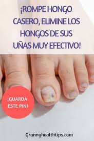 Pin On Hongos Pies Unas