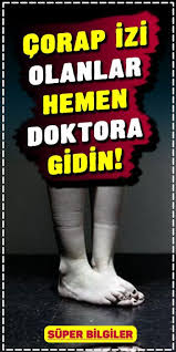 Corap Izi Olanlar Hemen Doktora Gidin Doktorlar Zayiflama Planlari Karin Kasi Mucadelesi