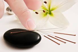 Image result for Acupuncture
