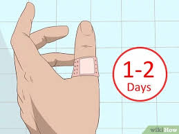 What is the best way to remove a splinter? 4 Ways To Remove A Deep Splinter Wikihow Life
