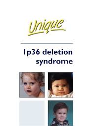 Chromosome 14 Deletion Life Expectancy