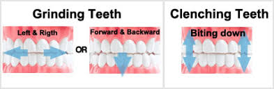 Check spelling or type a new query. How To Stop Clenching Teeth Teethwalls