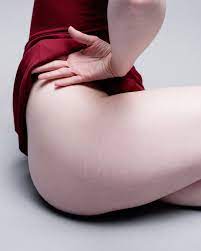 6 Women Show Off Stretch Marks In Portrait Series Allure