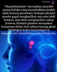 Check spelling or type a new query. Nak Fakta On Twitter Hypopituitarism Kelenjar Pituitari Tidak Mengeluarkan Cukup Hormon Nakfakta Nakbebel