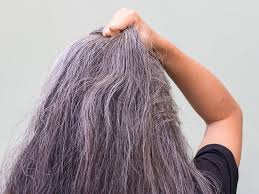 Sufficient research point out that deficiency of catalase and deposition of hydrogen peroxide in the hair roots are the main reasons for premature gray hair. Does Stress Cause Grey Hair It May Lead To Premature Graying