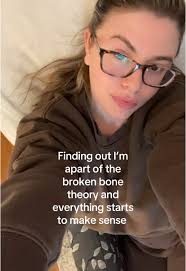 Is Today A Bones Day