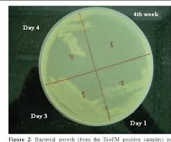 Image result for CSF Culture