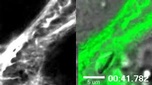 Berkarir di pt freeport indonesia merupakan idaman bagi kebanyakan fresh graduate. Genetic Impairment Of Parasite Myosin Motors Uncovers The Contribution Of Host Cell Membrane Dynamics To Toxoplasma Invasion Forces Bmc Biology Full Text