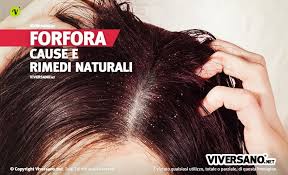 Sebbene nella cultura popolare il limone venga considerato un ottimo ingrediente per il trattamento dei capelli, gli esperti in dermatologia affermano che l'uso . Come Eliminare La Forfora Con Prodotti E Rimedi Naturali Efficaci