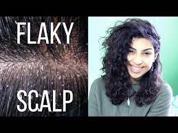Causes Fixes To A Flaky Scalp Youtube Flaky Scalp Curly Hair Tips Curly Hair Styles
