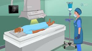 Image result for Voiding Cystourethrogram