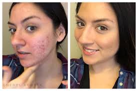 So, while traveling overChristmas break I forgot my SeneGence face wash and  other skincare products. This is what happened when I used my mom's VERY  expensive and boutique brand facial products. They