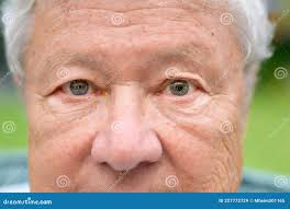 Blunt Trauma Stock Photos